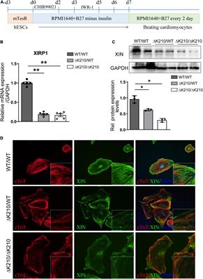 Cardiac Overexpression of XIN Prevents Dilated Cardiomyopathy Caused by TNNT2 ΔK210 Mutation